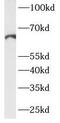 COX2 antibody, FNab09973, FineTest, Western Blot image 