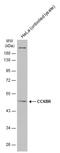 Cholecystokinin B Receptor antibody, GTX100347, GeneTex, Western Blot image 