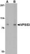 VPS53 Subunit Of GARP Complex antibody, NBP1-76901, Novus Biologicals, Western Blot image 