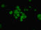 Nucleoporin 210 antibody, LS-B12271, Lifespan Biosciences, Immunofluorescence image 