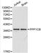 Protein Phosphatase 1 Catalytic Subunit Beta antibody, LS-C192363, Lifespan Biosciences, Western Blot image 