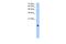 Paired Immunoglobin Like Type 2 Receptor Alpha antibody, A07502, Boster Biological Technology, Western Blot image 