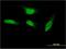 SEC14 Like Lipid Binding 2 antibody, H00023541-M05, Novus Biologicals, Immunocytochemistry image 