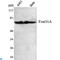 Forkhead Box O1 antibody, LS-C812971, Lifespan Biosciences, Western Blot image 