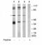 G Protein-Coupled Receptor Kinase 5 antibody, ab64943, Abcam, Western Blot image 