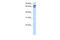 Transcription Factor 25 antibody, 26-246, ProSci, Enzyme Linked Immunosorbent Assay image 