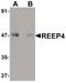 Receptor Accessory Protein 4 antibody, PA5-20885, Invitrogen Antibodies, Western Blot image 