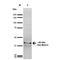 Sodium Voltage-Gated Channel Beta Subunit 2 antibody, LS-C773696, Lifespan Biosciences, Western Blot image 