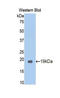 Carcinoembryonic Antigen Related Cell Adhesion Molecule 5 antibody, LS-C298705, Lifespan Biosciences, Western Blot image 