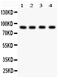 Furin, Paired Basic Amino Acid Cleaving Enzyme antibody, PB9182, Boster Biological Technology, Western Blot image 