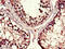 Dynein Cytoplasmic 1 Heavy Chain 1 antibody, LS-B15196, Lifespan Biosciences, Immunohistochemistry paraffin image 