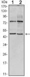 THAP Domain Containing 11 antibody, GTX82796, GeneTex, Western Blot image 