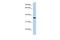 Phosphoseryl-TRNA Kinase antibody, A13657, Boster Biological Technology, Western Blot image 