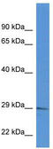 RAB2B, Member RAS Oncogene Family antibody, TA343025, Origene, Western Blot image 