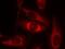 p53 antibody, 79-449, ProSci, Immunofluorescence image 