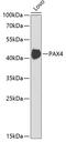 Paired Box 4 antibody, GTX64523, GeneTex, Western Blot image 