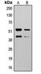 Matrix Metallopeptidase 10 antibody, LS-C354041, Lifespan Biosciences, Western Blot image 