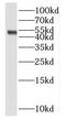 Pygopus Family PHD Finger 2 antibody, FNab06978, FineTest, Western Blot image 