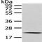 Mediator Complex Subunit 18 antibody, TA350537, Origene, Western Blot image 
