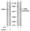 RELB Proto-Oncogene, NF-KB Subunit antibody, GTX78951, GeneTex, Western Blot image 