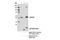 RAD23 Homolog A, Nucleotide Excision Repair Protein antibody, 24555S, Cell Signaling Technology, Immunoprecipitation image 