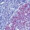 MutS Homolog 2 antibody, MA5-12224, Invitrogen Antibodies, Immunohistochemistry paraffin image 