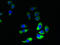 GRAM Domain Containing 1B antibody, LS-C395135, Lifespan Biosciences, Immunofluorescence image 