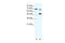 Lysine Methyltransferase 2B antibody, 27-926, ProSci, Enzyme Linked Immunosorbent Assay image 