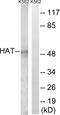 Histone Acetyltransferase 1 antibody, LS-C118604, Lifespan Biosciences, Western Blot image 