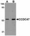 Coiled-Coil Domain Containing 47 antibody, LS-B4622, Lifespan Biosciences, Western Blot image 