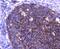 Complement C3d Receptor 2 antibody, NBP2-67605, Novus Biologicals, Immunohistochemistry paraffin image 