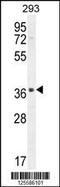 Sperm Acrosome Associated 1 antibody, 55-410, ProSci, Western Blot image 