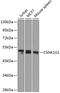 Casein Kinase 1 Gamma 1 antibody, 15-392, ProSci, Western Blot image 