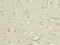 NADH:Ubiquinone Oxidoreductase Subunit B10 antibody, LS-C676132, Lifespan Biosciences, Immunohistochemistry paraffin image 
