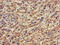 ATP Binding Cassette Subfamily A Member 5 antibody, LS-C501485, Lifespan Biosciences, Immunohistochemistry frozen image 