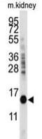 Cytidine Deaminase antibody, ab82346, Abcam, Western Blot image 