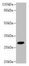 Phosphatidylinositol-4,5-Bisphosphate 4-Phosphatase 2 antibody, CSB-PA023855LA01HU, Cusabio, Western Blot image 