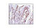 Cyclin D1 antibody, 2978T, Cell Signaling Technology, Immunohistochemistry paraffin image 