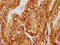 Forkhead Box O3 antibody, CSB-RA008836A0HU, Cusabio, Immunohistochemistry frozen image 