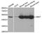 4-Aminobutyrate Aminotransferase antibody, LS-B14889, Lifespan Biosciences, Western Blot image 