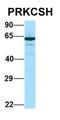 Protein Kinase C Substrate 80K-H antibody, orb331256, Biorbyt, Western Blot image 