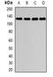 Dishevelled Associated Activator Of Morphogenesis 2 antibody, orb341306, Biorbyt, Western Blot image 