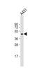 Keratin 14 antibody, MBS9207944, MyBioSource, Western Blot image 