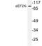 Eukaryotic Elongation Factor 2 Kinase antibody, LS-C177795, Lifespan Biosciences, Western Blot image 