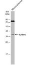 Insulin Like Growth Factor Binding Protein 3 antibody, NBP2-16933, Novus Biologicals, Western Blot image 