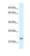 Rho Family GTPase 1 antibody, orb326396, Biorbyt, Western Blot image 