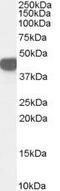 Argininosuccinate Synthase 1 antibody, GTX89088, GeneTex, Western Blot image 