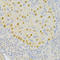 6-Phosphofructo-2-Kinase/Fructose-2,6-Biphosphatase 3 antibody, STJ29025, St John