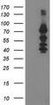 Katanin Regulatory Subunit B1 antibody, TA503807S, Origene, Western Blot image 