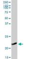 NADH:Ubiquinone Oxidoreductase Subunit B10 antibody, H00004716-D01P, Novus Biologicals, Western Blot image 